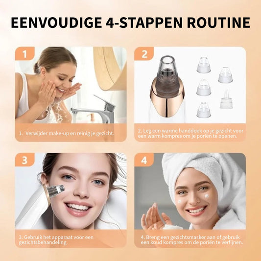 Mee-eter Professionele Verwijderaar