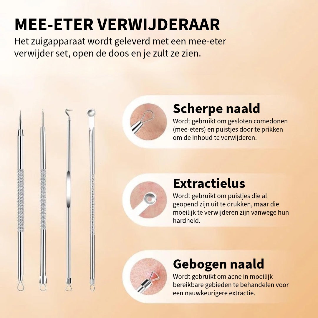 Mee-eter Professionele Verwijderaar