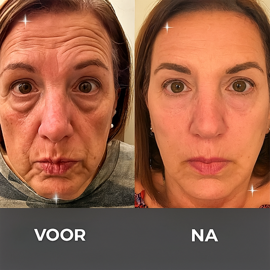 Natuurlijke Rimpelcrème